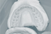 Dental cast
