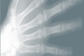 Carpus X-ray