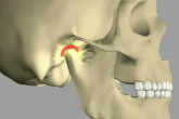 Temporomandibular joint